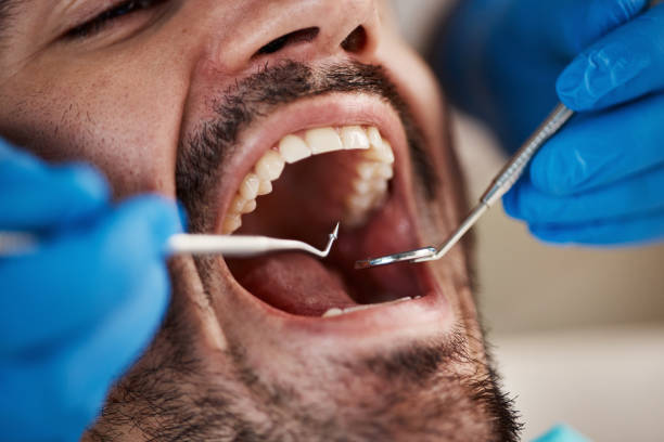 Dentist for Dental Trauma in GA